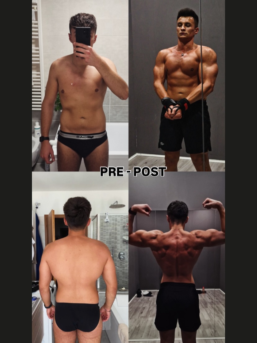Pre e post di un atleta Tunnel Vision arrivato fino alla gara di bodybuilding con medaglia